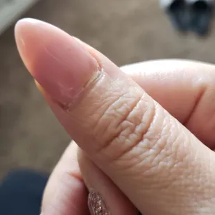 Yes it's lifting. Plus my cuticle looks horrible.