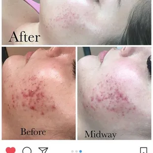 Here's some before and after pics :)