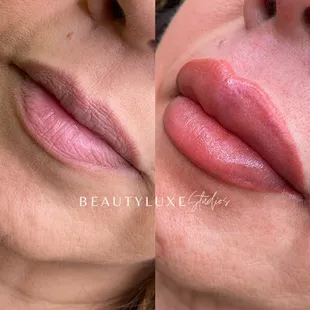 Lip Blushing