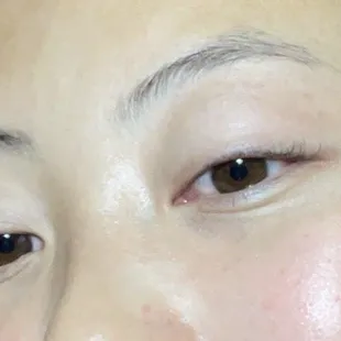 before eyebrows