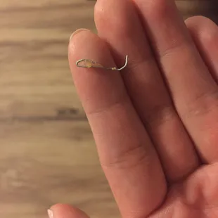 Staple found in her mouth while eating pizza! "Yes, um, can we get a large Ham and pineapple pizza? Oh and add extra staples. Thanks"