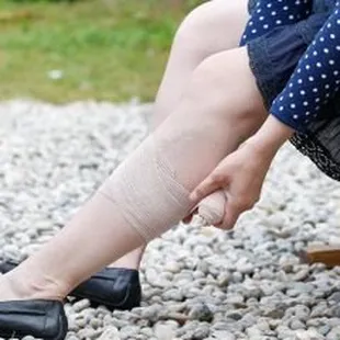 Pharmacy Shares the Dos &amp; Don'ts For Dealing With Varicose Veins