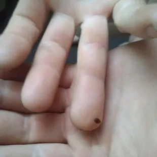 Bed bugs. Nuff said.