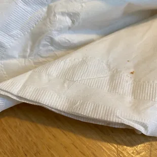 Also found this hair in the food