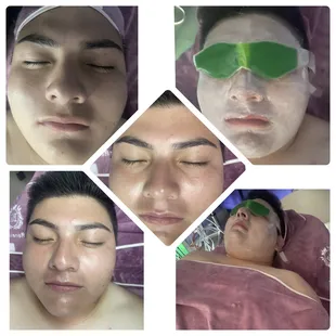Glowing and black heads remove facial