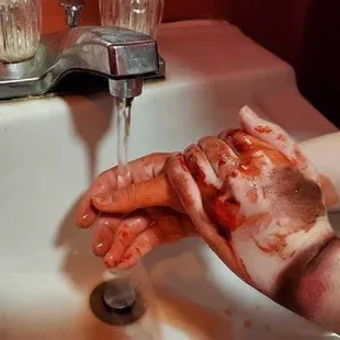 My wife's mangled hands.