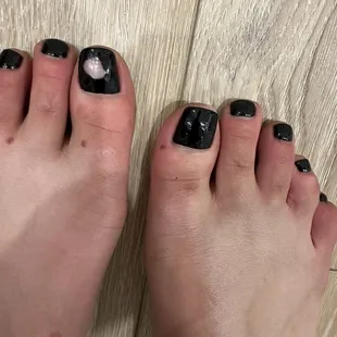 Horrible pedicure.