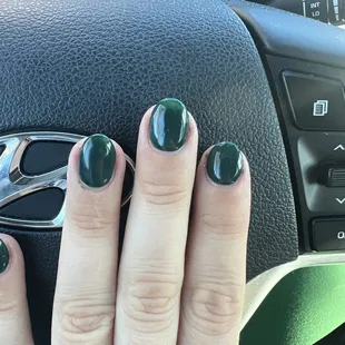 Left pointer finger is significantly shorter than the rest.