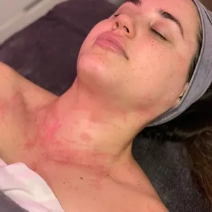 Plasmatic Effect (DMK Enzyme Therapy)