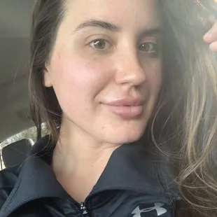 After no filter in sunlight