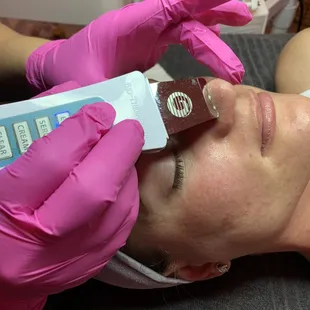 Skin Scrubber Extractions