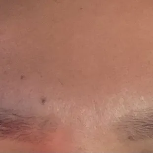 Brow threading