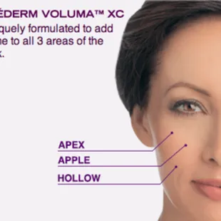 Area&apos;s Voluma can treat