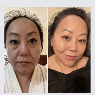 A Beauty Glo Service