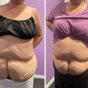 Took 6 inches off circumference and 4 off the bottom