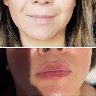 Hya infused lips for some volume