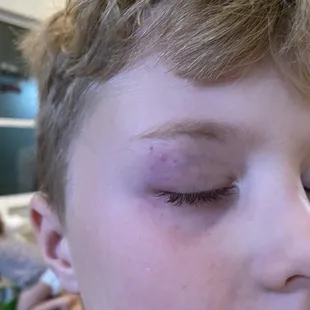 Sons black eye due to neglect in safety measures