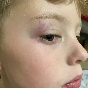 Sons black eye due to neglect in safety measures
