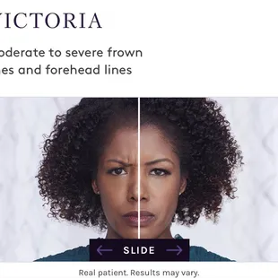 Now introducing Botox at BMC! Call to book your appointment.