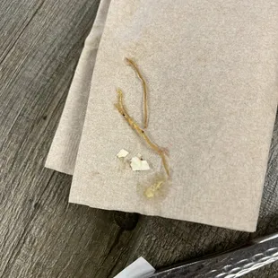 Egg shells and brown stringy material my friend choked on.