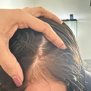 Cracked her skin on scalp by pulling her hair and dragging her