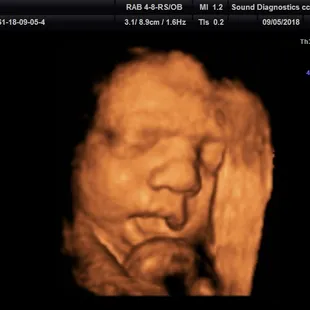 32 Weeks Mouth open