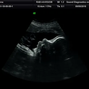 36 Week 2d profile