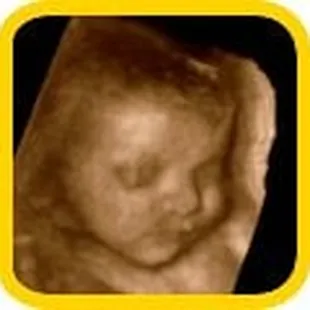 4D Baby Sonograms