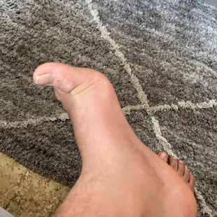 burger king foot lettuce