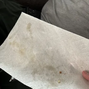 Multiple Hairs in food