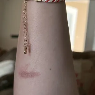 a woman's arm with a tattoo on it