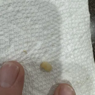 Finger nail