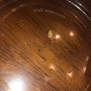 A hair and raw chicken in my bowl.