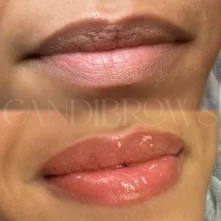 Lip blushing to neutralize dark or uneven lips