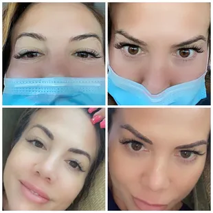 Top is before. Bottom is after!