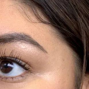 After (taken 06/20/19)