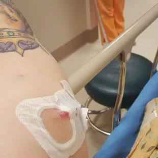 IV inserted main artery due to mass dehydration from food poisioning.