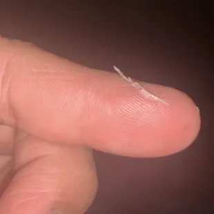Hard plastic shard found in my strawberry shake, it poked me