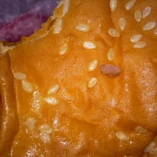 I found these piece of teeth in hethe burger