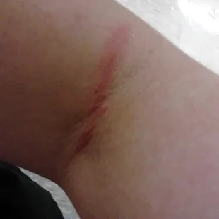 My friend&apos;s arm (per my review)