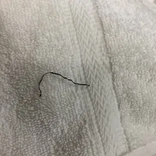 Wire in soup, caused injury