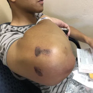 a man with a wound on his stomach