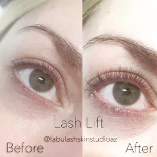 Enhancing natural beauty