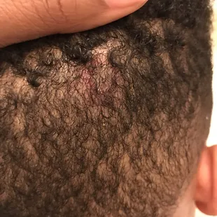 Paintball to the head .