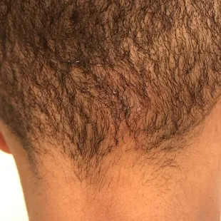 Paintball to the neck.