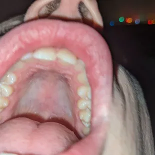 Me going in for a crazy bite