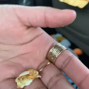 WHAT IS THIS BRO