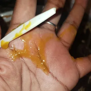 Grease from gravy &amp; how it burned my hand