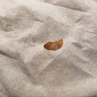 The fingernail found...so disgusting and unacceptable!