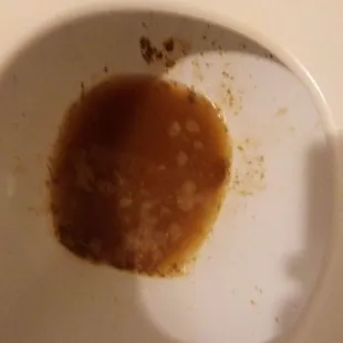 This is what you get when you eat at super China buffet! WE DO NOT RECOMMEND EATING AT THIS NASTY DUMP!